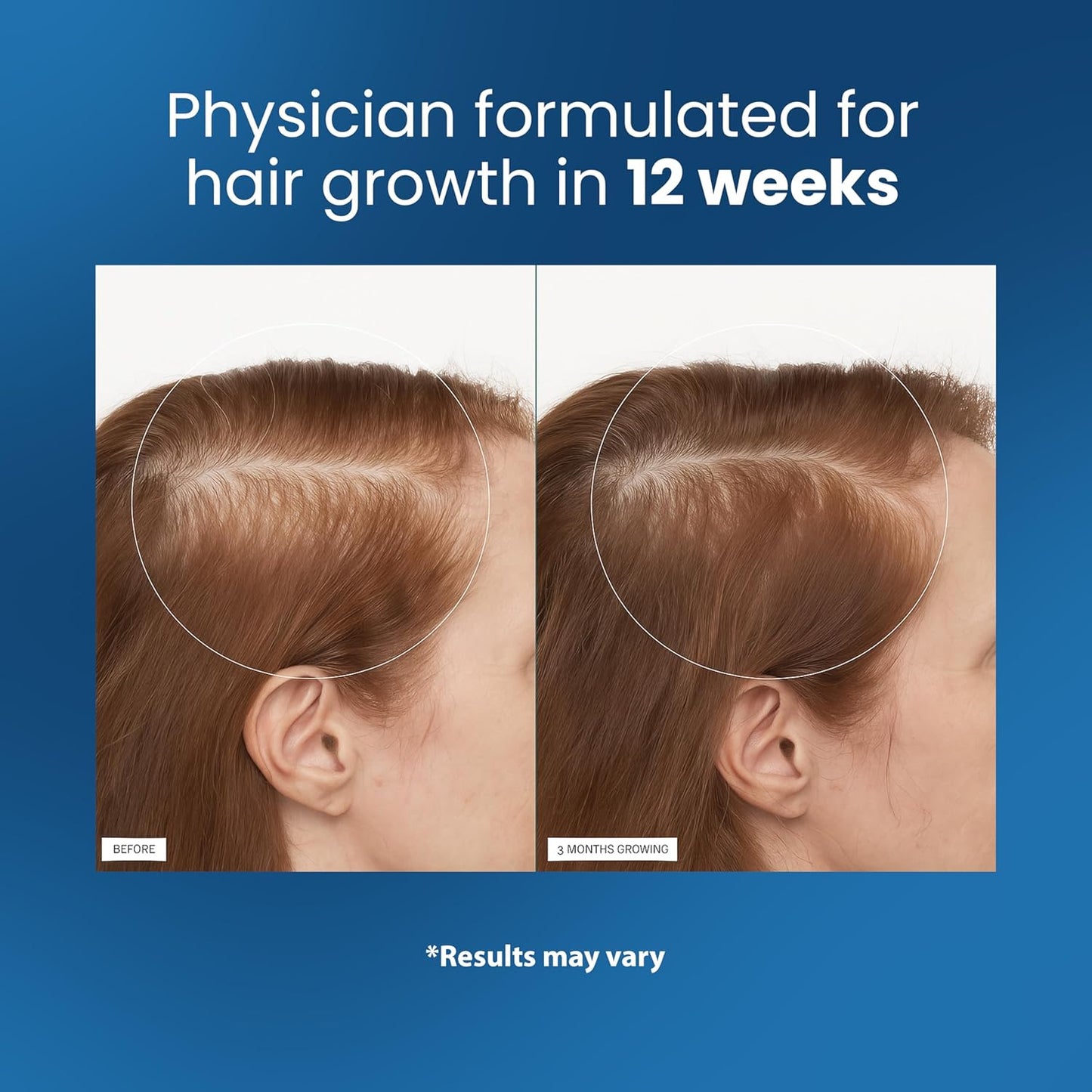 Hair Growth Serum Roll‑On